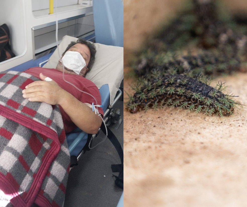 Um mês após ser internado por encostar em taturana venenosa, idoso segue passando por hemodiálise em Campos do Jordão, SP