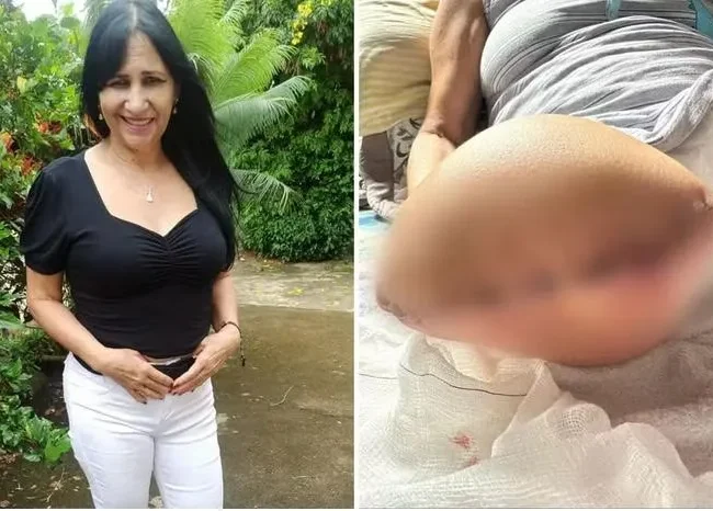 Médico Indiciado após Erro em Cirurgia Resultar em Amputação de Perna de Idosa