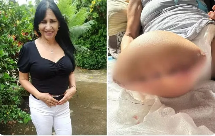 Médico Indiciado após Erro em Cirurgia Resultar em Amputação de Perna de Idosa