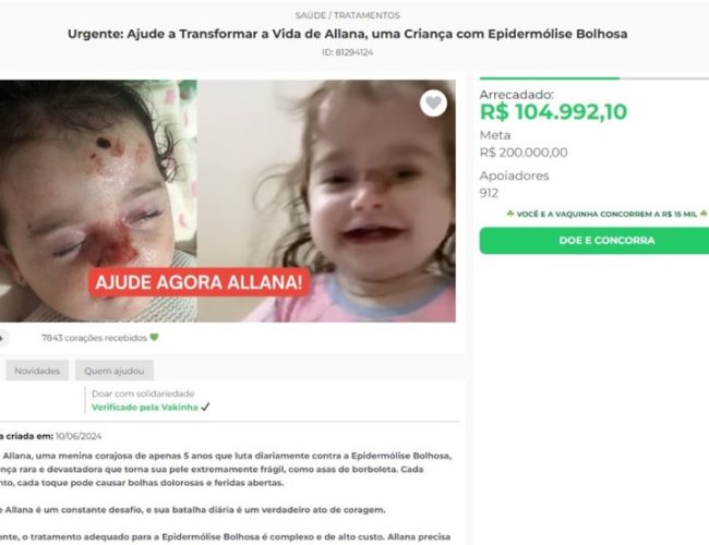 Polícia investiga suspeitos de usarem fotos de criança com doença rara para arrecadar dinheiro