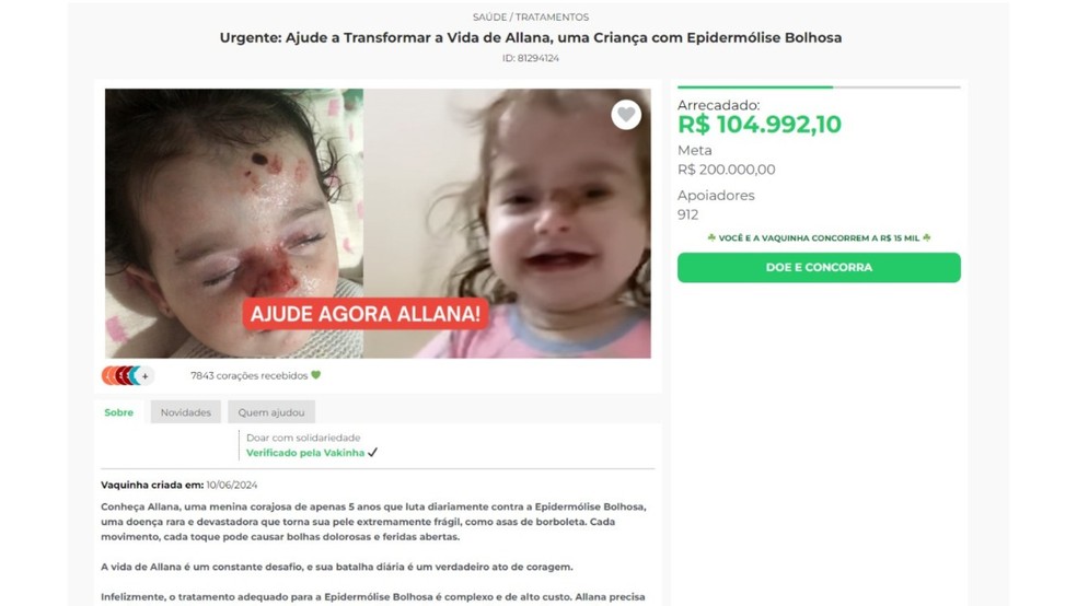 Polícia investiga suspeitos de usarem fotos de criança com doença rara para arrecadar dinheiro