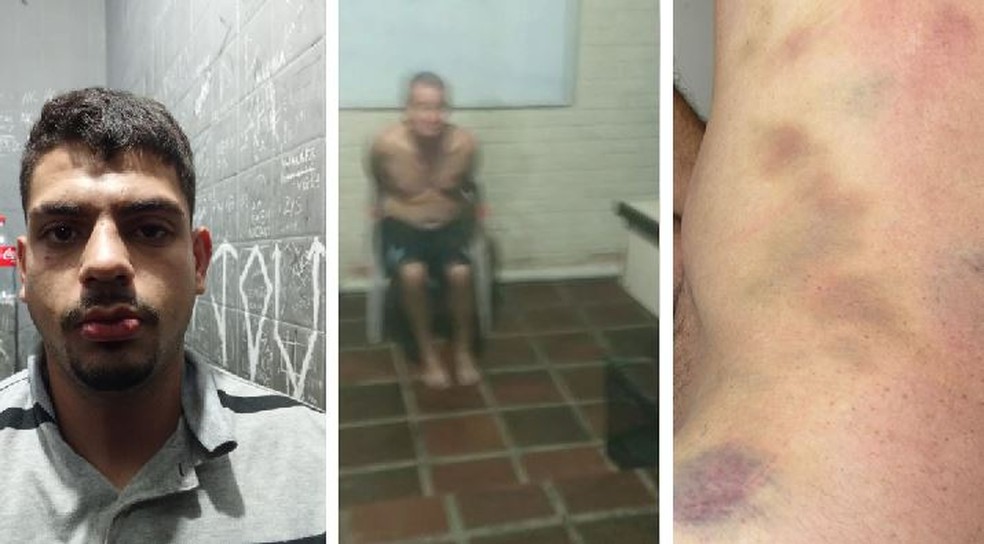 MP denuncia funcionário de clínica à Justiça por tortura e morte de paciente na Grande SP